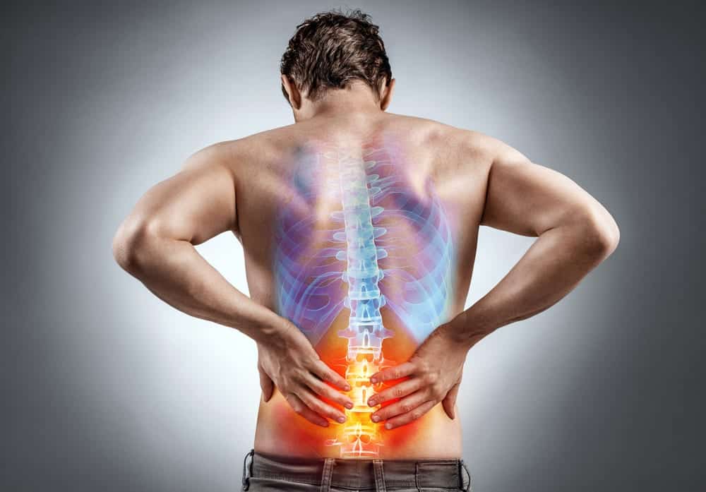 Natural Ways to Alleviate Back Pain Without Medication